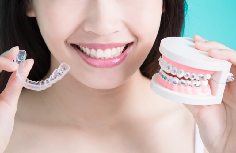 Şeffaf Plak Tedavisi mi Tel Tedavisi mi? Ortodonti Orthodontics
