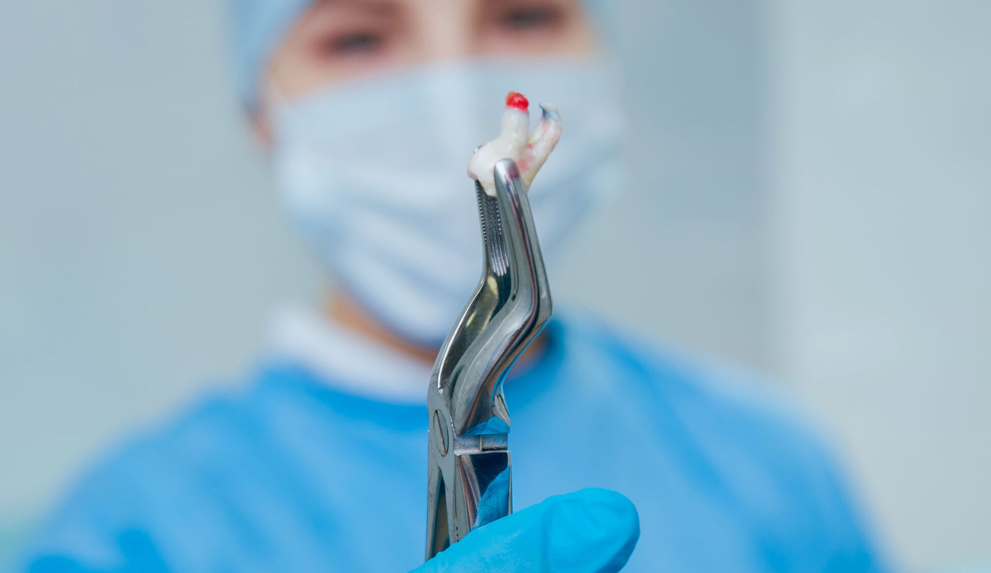 Oral Surgery 20 yaş diş çekimi diş ağrısı çekim Simyadent