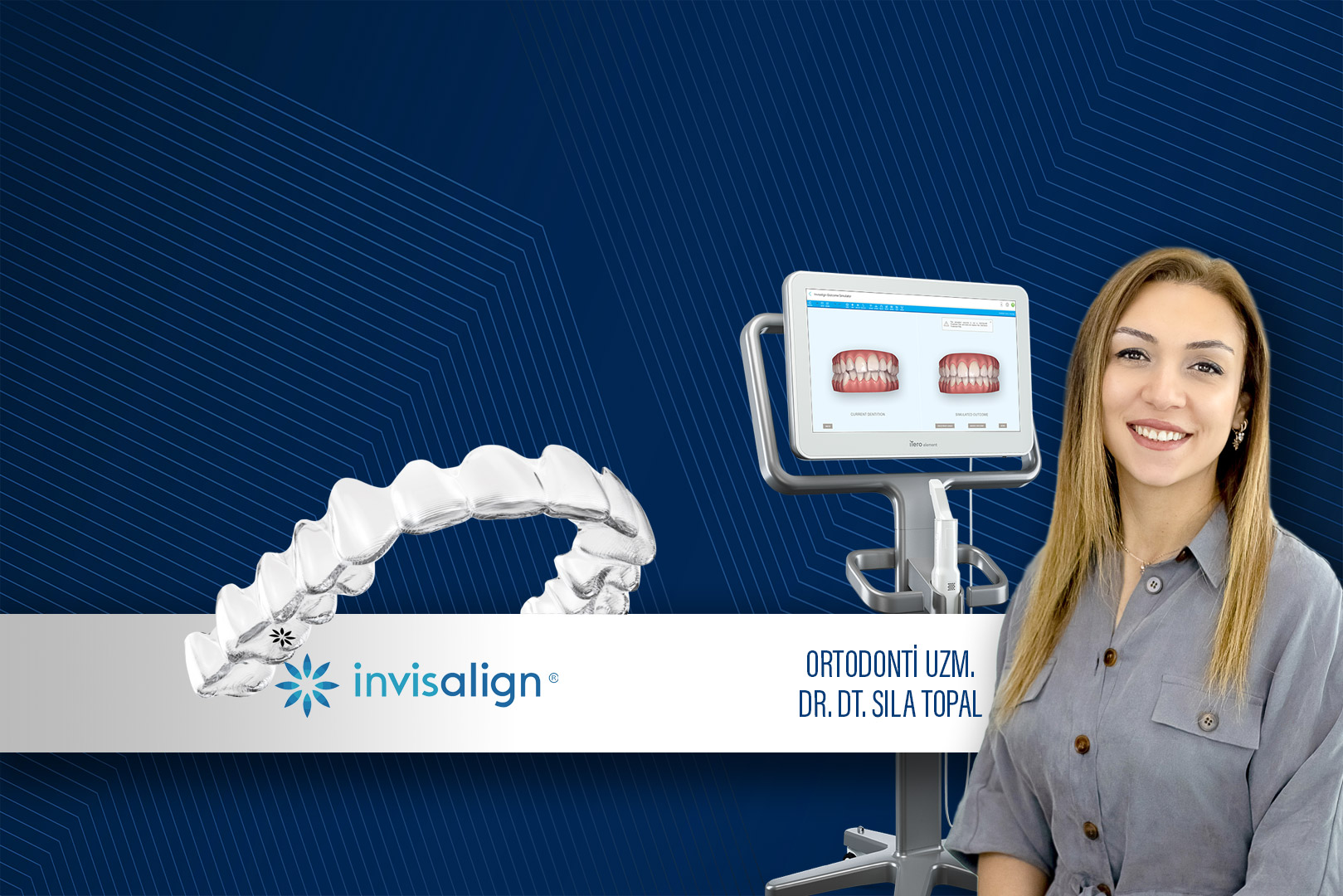 Invisalign® - Şeffaf Plak Invisalign Sıla Topal
