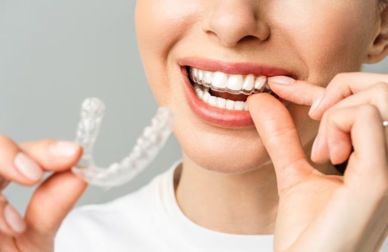 Ankara Invisalign İle Çapraşıklık Tedavisi ankara invisalign simyadent