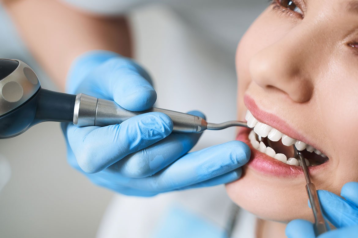 Kanal Tedavisi Sonrası Ağrı Nasıl Geçer? Kanal Tedavisi Sonrasi Agri