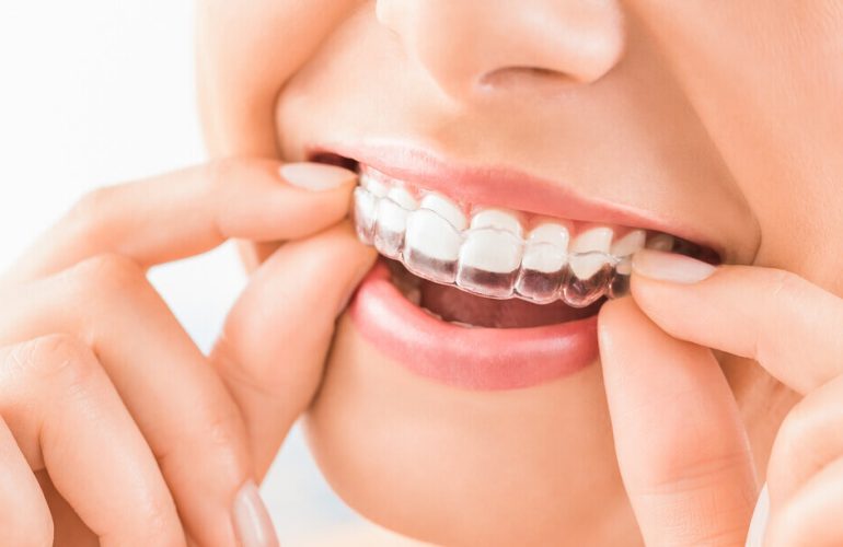 Ortodonti Tedavi Fiyatları Ortodonti Tedavi Fiyatlari