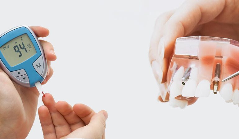 Şeker Hastası Diş İmplantı Yaptırabilir mi? seker hastalarina implant
