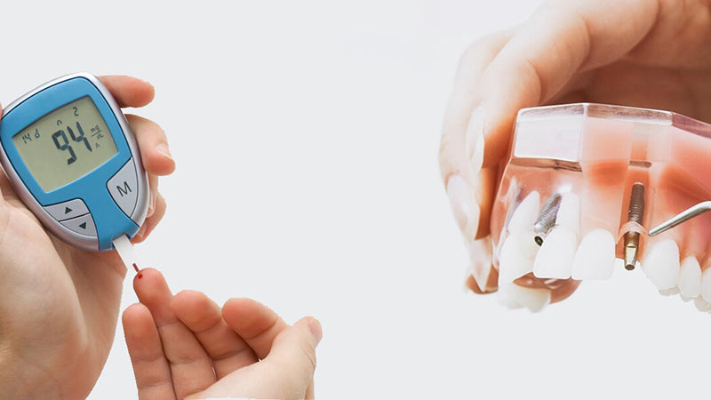 seker hastalarina implant