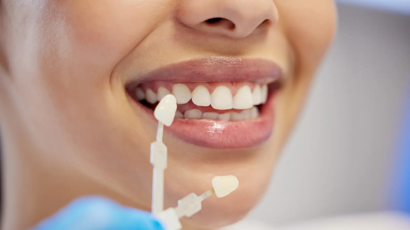 Turkiyede Zirkonyum Dis Yaptirmak