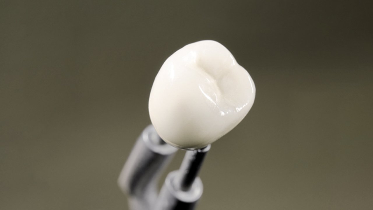 Zirkonyum Kaplama Sonrasi Dikkat Edilmesi Gerekenler