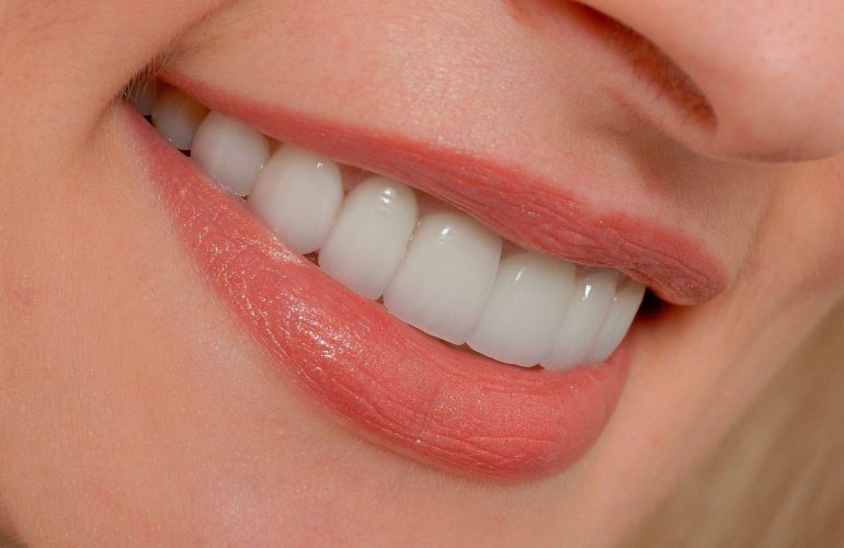 Porselen Diş Kaplama: Estetik ve Fonksiyonelliğin Kusursuz Buluşması Porselen Dis Kaplama