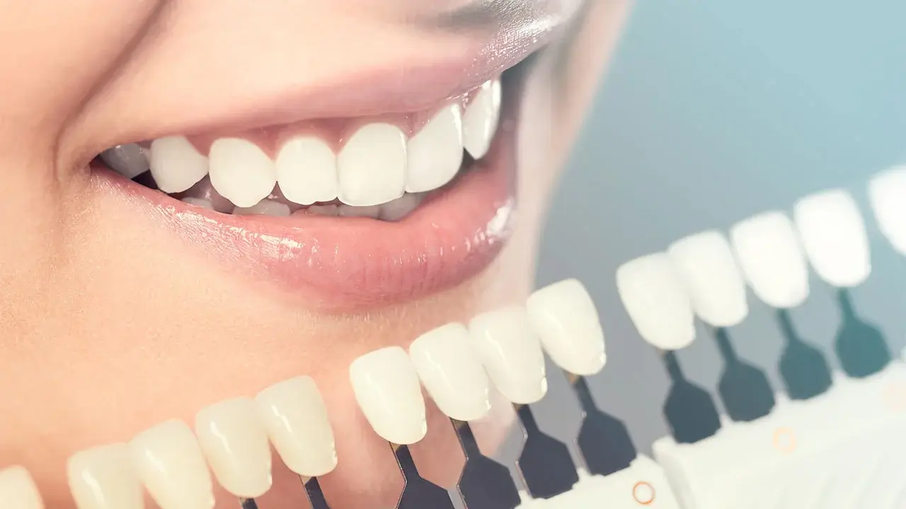 Porselen Dis Kaplama Fiyatlari