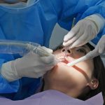 Diş Kisti Belirtileri