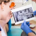 Dişte Kemik Erimesi Belirtileri