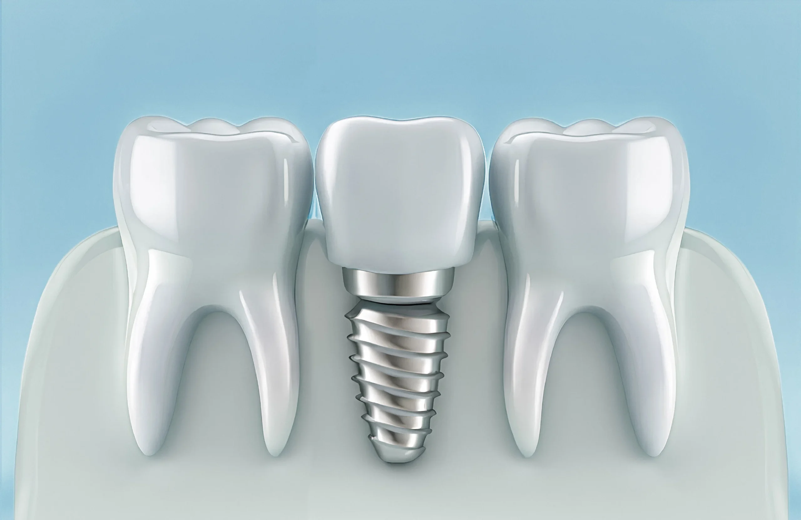 Top 7 Essential Preparations Before Your Dental Implant Treatment Top 7 Essential Preparations Before Your Dental Implant Treatment