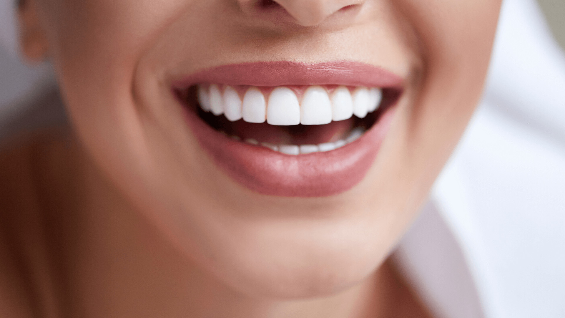 Ankara Laminate Veneers