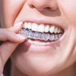 Ankara Orthodontic Treatment