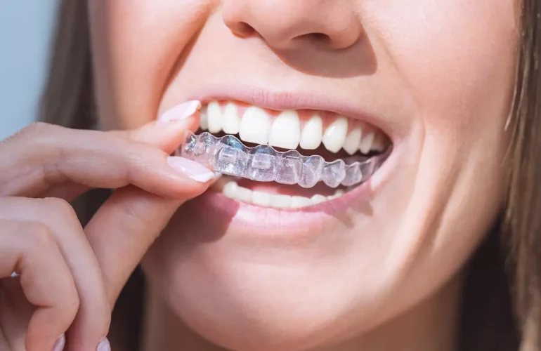 Ankara Orthodontic Treatment: Comprehensive Guide to Modern Smile Correction Ankara Orthodontic Treatment