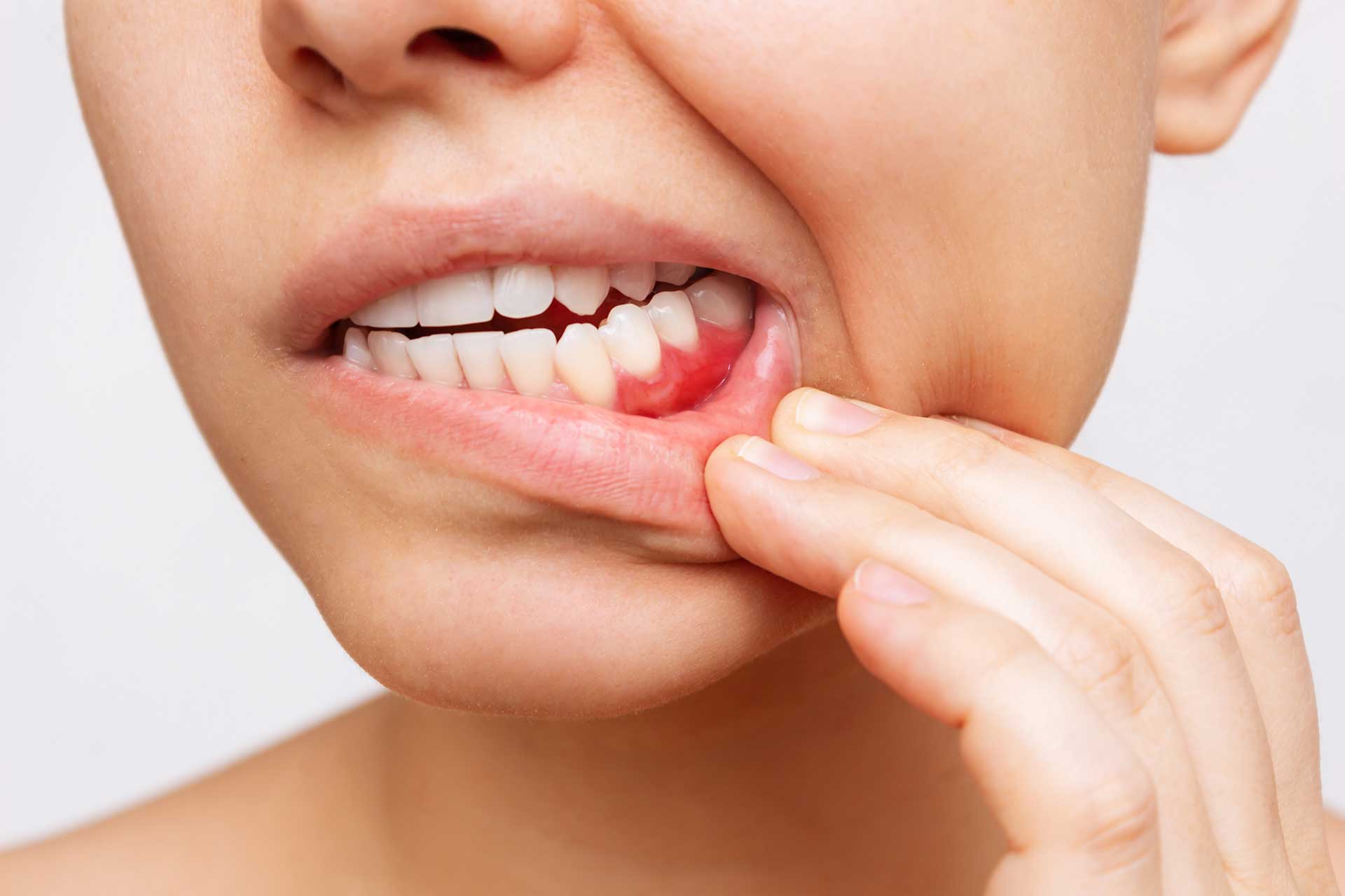 Gum Problems: Causes, Symptoms, Treatment, and Prevention Gum Problems