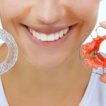 What Are the Stages of Invisalign Treatment 1
