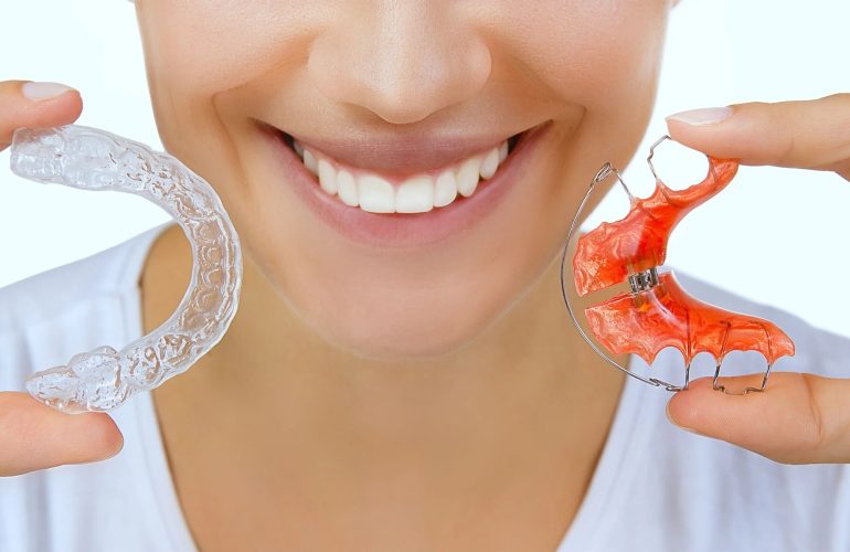 What Are the Stages of Invisalign Treatment 1