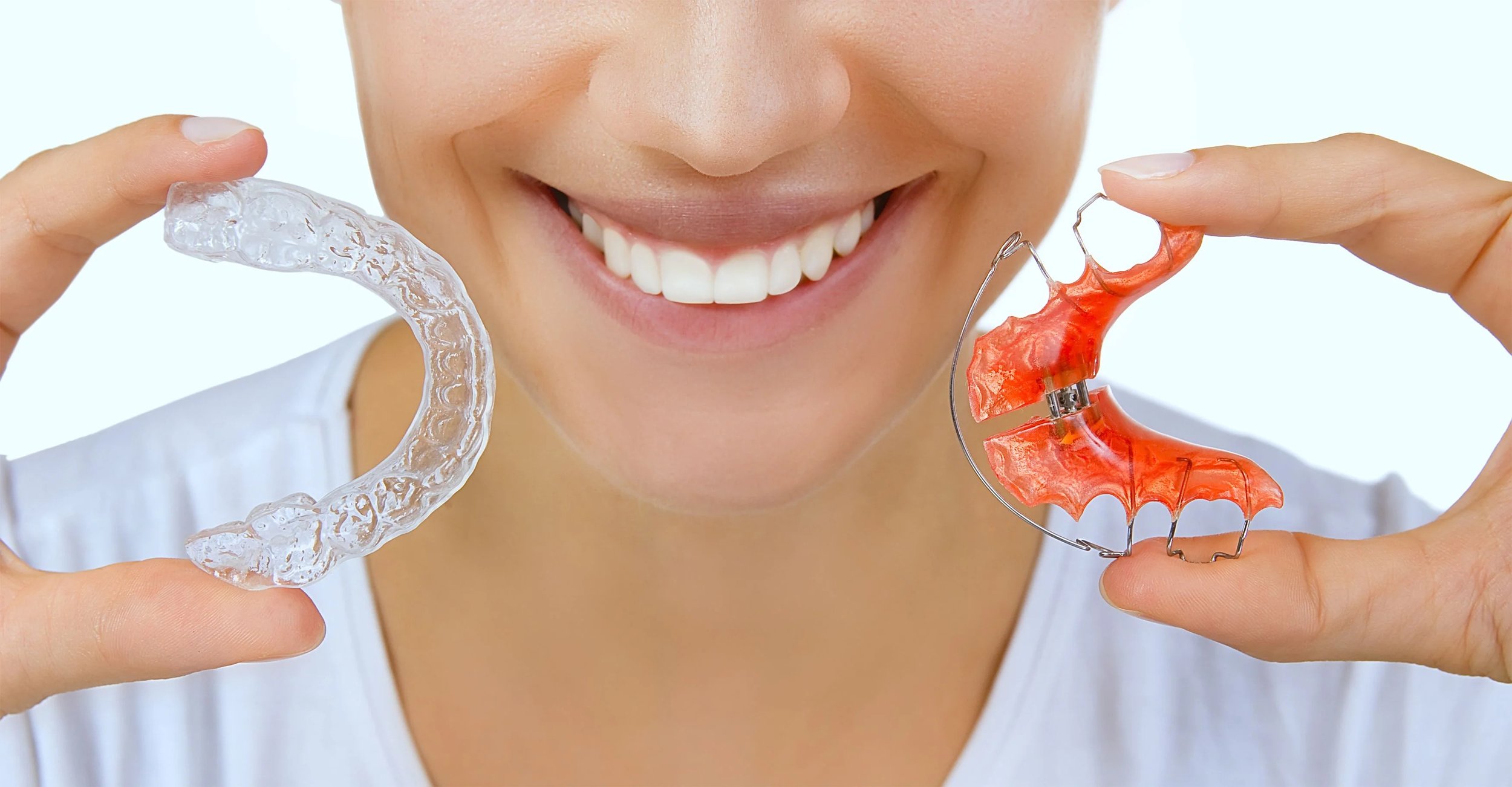 What Are the Stages of Invisalign Treatment 1