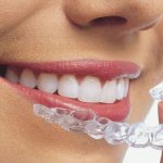 Dis Plak Fiyatlari 2