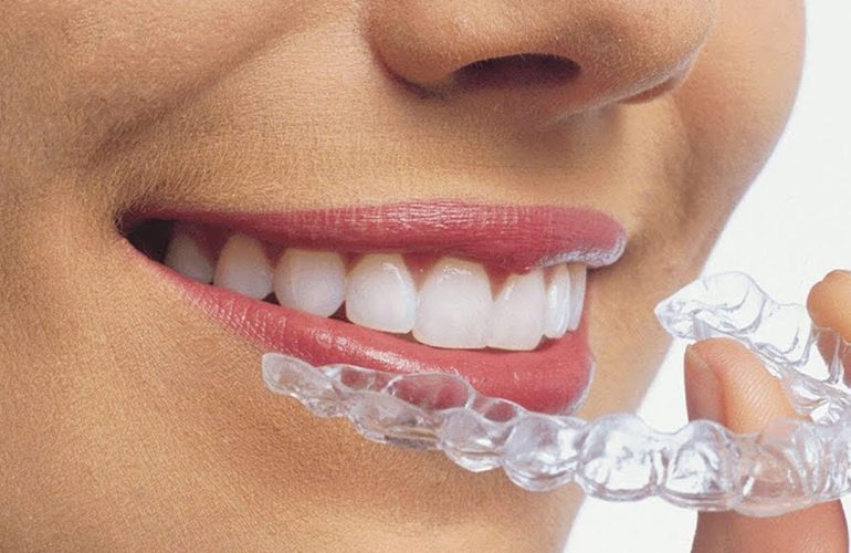 Dis Plak Fiyatlari 2