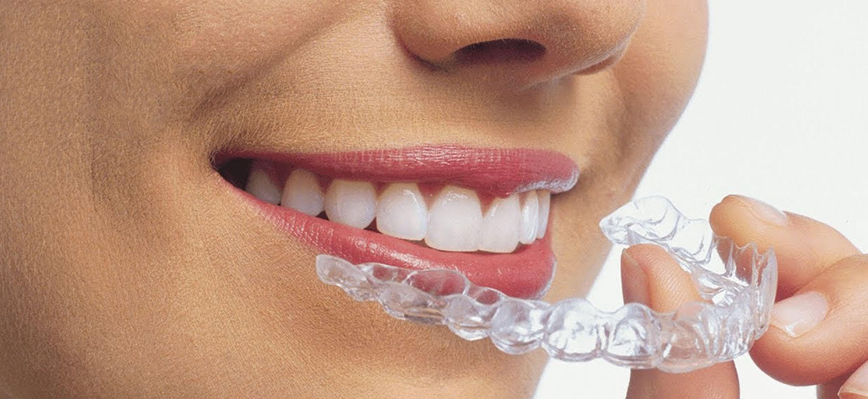 Dis Plak Fiyatlari 2