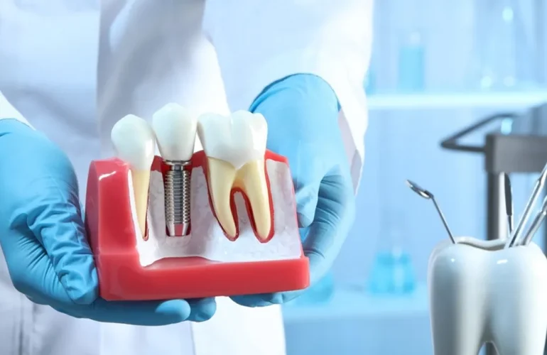 Implant Turleri ve Materyalleri