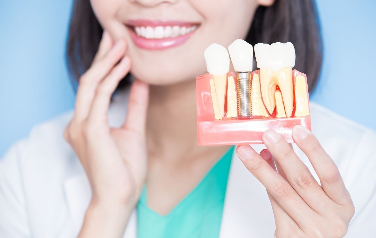İmplant Üstü Kaplama Düşmesi Implant Ustu Kaplama Dusmesi