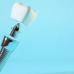 Zirkonyum implant